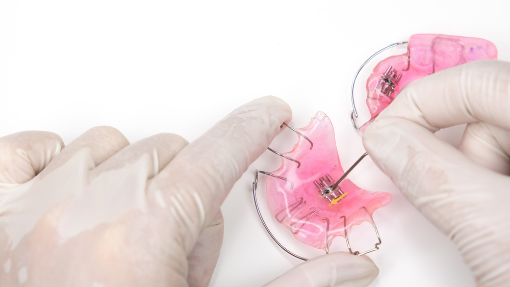 千葉県袖ケ浦市のホームデンタルクリニック(JR内房線長浦駅徒歩5分)では、お子さまの成長を活かした床矯正によって、あごの発育をサポートしながら将来の歯並びを整えます。抜歯のリスクを抑え、自然な噛み合わせへ導く矯正治療をご提案しています。