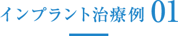 インプラントの治療例01