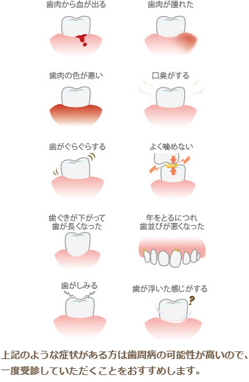 歯周病が疑われる症状一覧